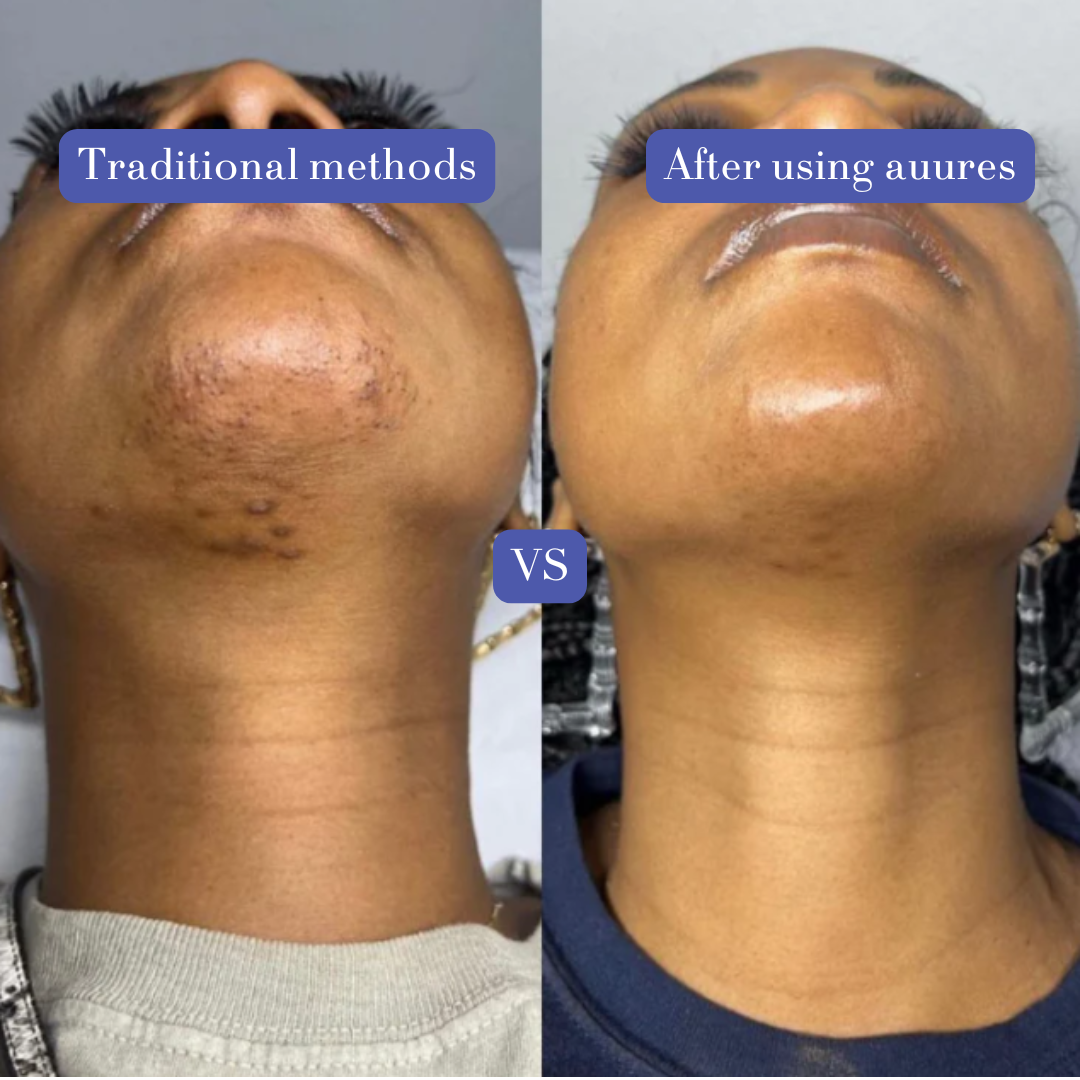 Smooth Skin Kit