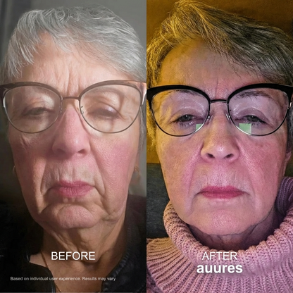 Facelift Massager 2.0